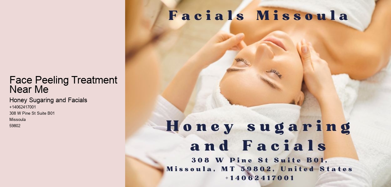 Face Peeling Treatment Near Me